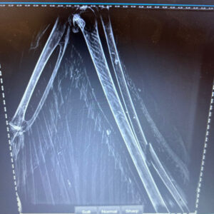 X-ray shows fractured radius of marabou stork