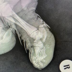 xray of pangolin foot